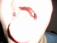  Vid` karijesa! A tek zadah!! Superhik je amater!!!