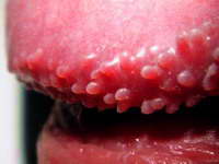 Pri�ti�i na penisu