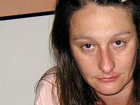 bolujem ja, bolujes ti...