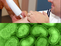 Jedan od virusa gripe. Cijepljenjem osna�ujete vlastiti imunitet.